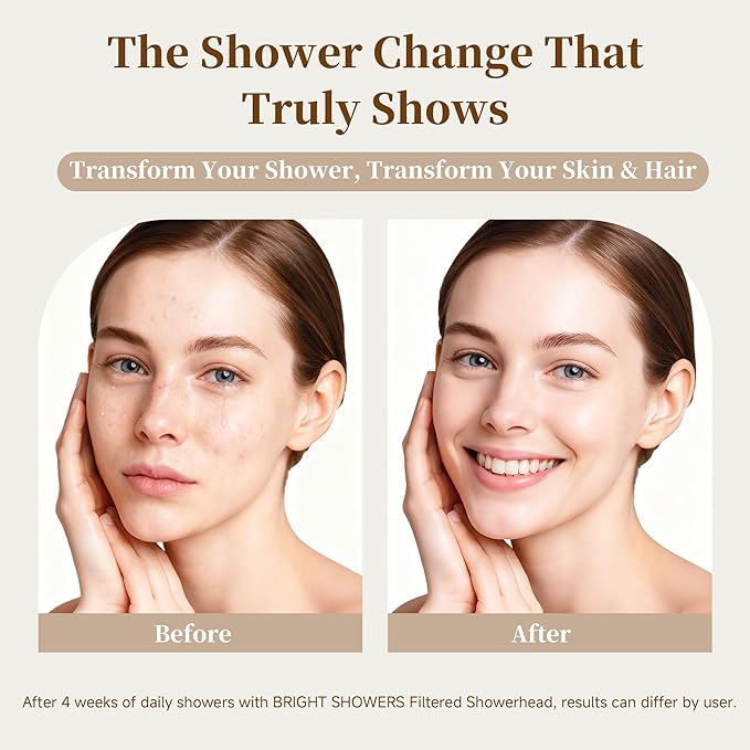 BRIGHT SHOWERS Filtered Shower Head, High Pressure Fixed Showerhead for Hard Water, Dual-Media Filter Removes Chlorine & Impurities, 8 Spray Modes, Matte Black