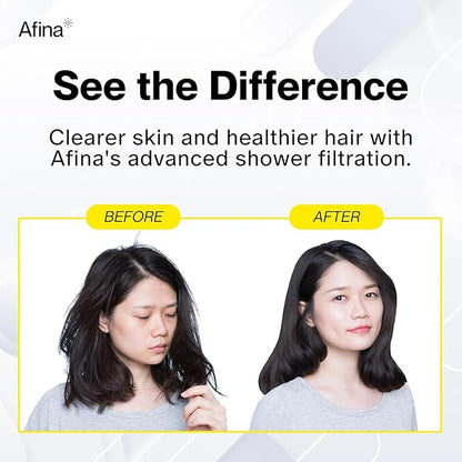 Afina Filtered Shower Head, Shower Filter for Hard Water | Improves Skin & Hair by Removing Chlorine & Toxic Chemicals from Hard Water (1.8 Gallon Per Minute California, Chrome)