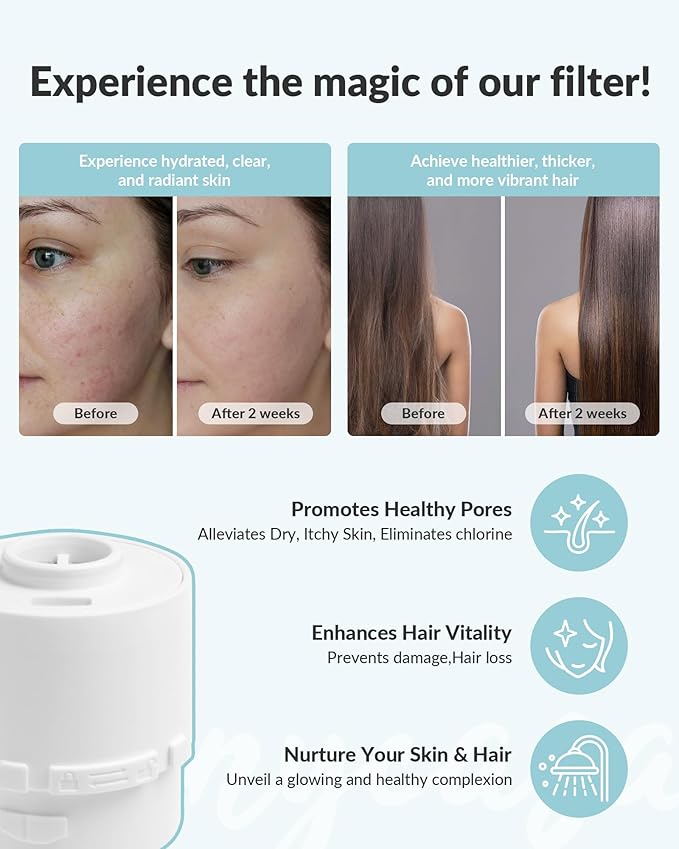 Shower Filter for SANYCASA Beauty Shower Head, KDF-55 Filter Dermatologist Recommended for Softening Hard Water, Improves Hair & Skin