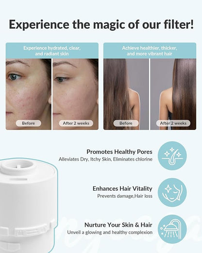 Shower Filter for SANYCASA Beauty Shower Head, KDF-55 Filter Dermatologist Recommended for Softening Hard Water, Improves Hair & Skin
