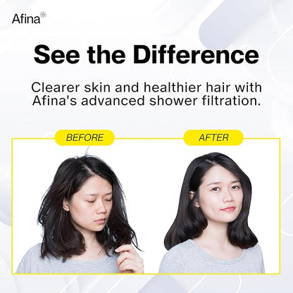 Afina Filtered Shower Head - Water Softener Showerhead with KDF-55 Shower Filter for Hard Water - High Pressure Rain Fall Experience - Universal Fit - Matte Black